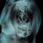 Ruger – Muhammad Ali (Can’t Relate) (Remix) Ft. Ayetian